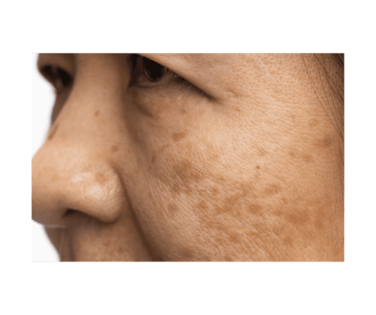 skin care