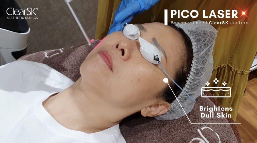 A woman undergoes a Pico laser treatment