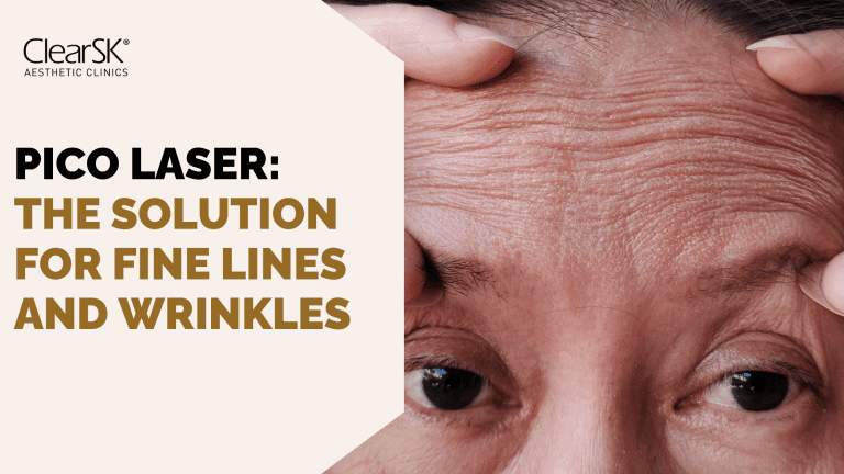 Pico Laser Solution for Fine Lines and Wrinkles