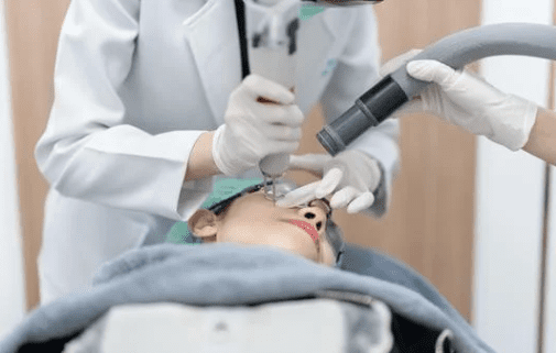 Pico laser for acne and acne scars