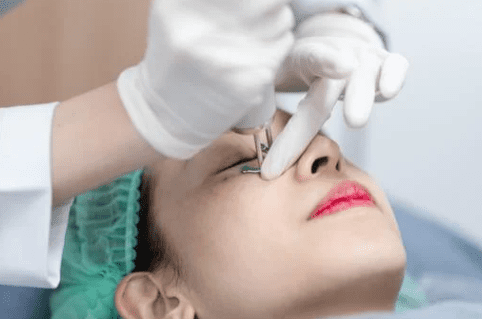 pico laser treatment under eye