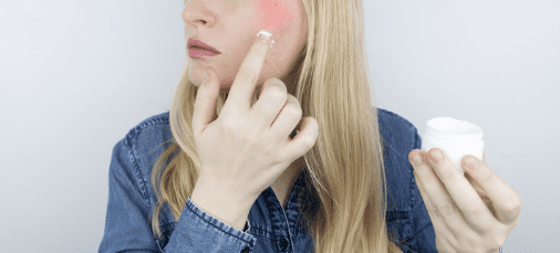 adult acne blemishes
