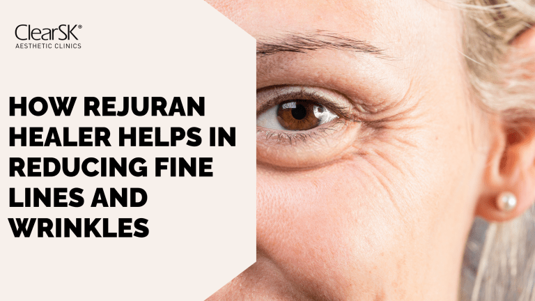 How Rejuran Healer Helps in Reducing Fine Lines and Wrinkles