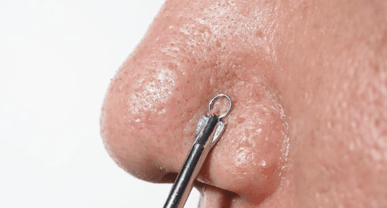 pdrn rjr for enlarged pores