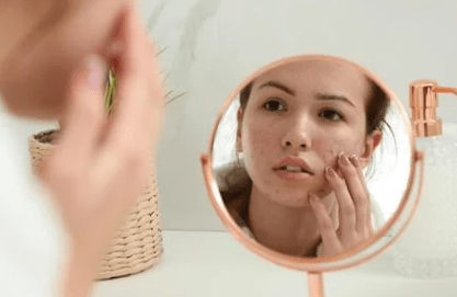 premature skin ageing