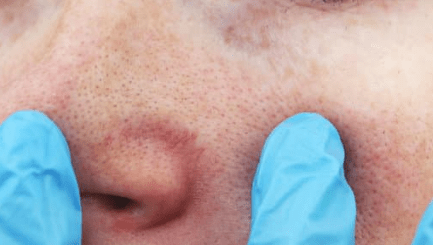 sy-firm for textured face