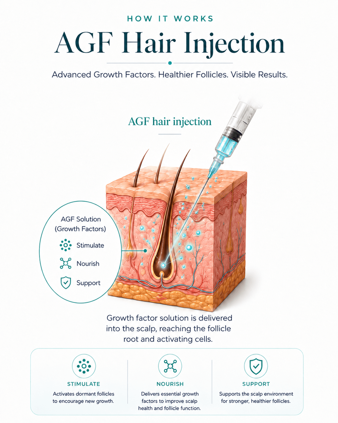 AGF Hair Injection for scalp and follicle support