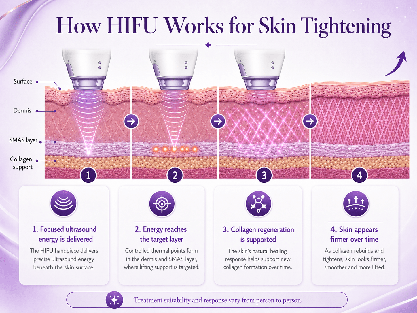 How HIFU works for skin tightening