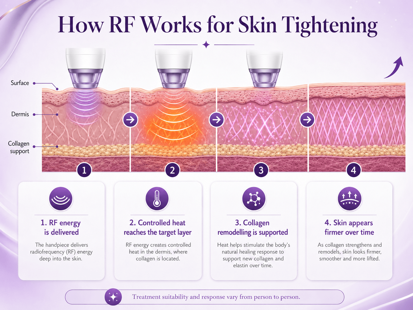 How RF works for skin tightening infographic placeholder