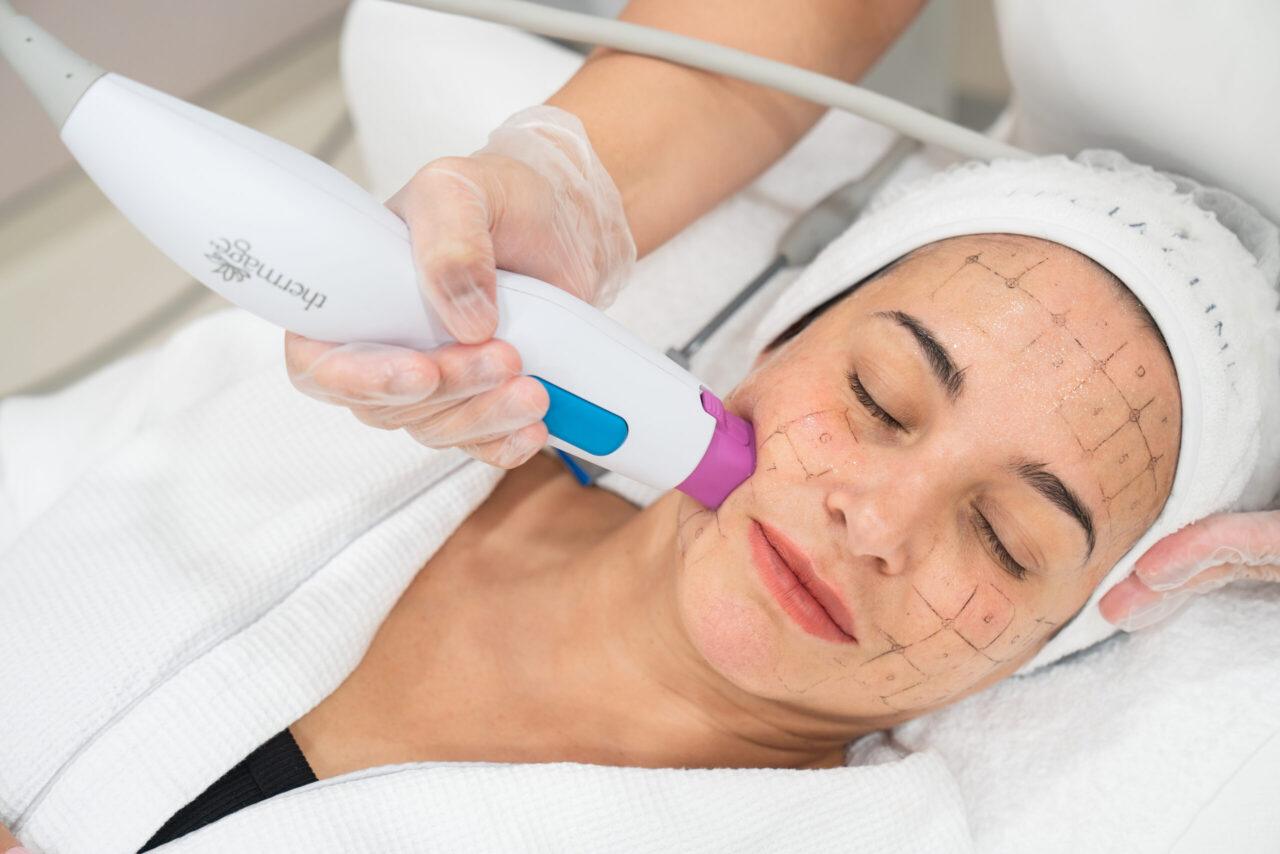 US FDA-cleared FLX RF Tightening image placeholder