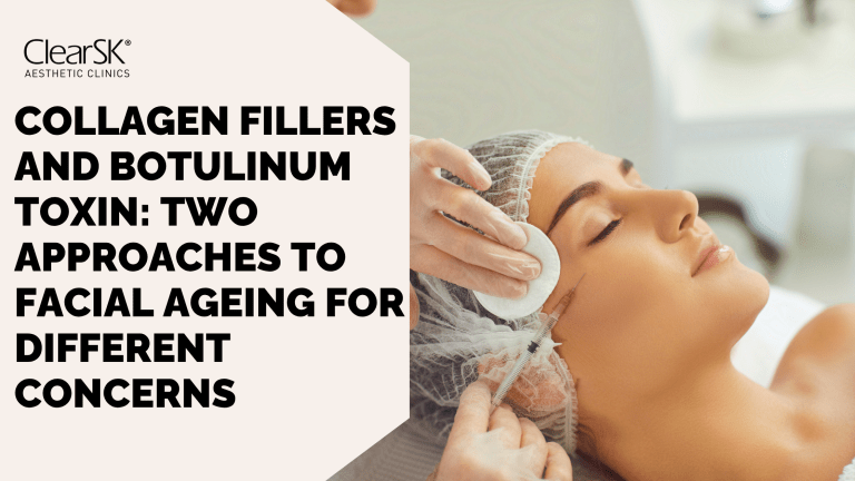 Collagen Fillers and Botulinum Toxin