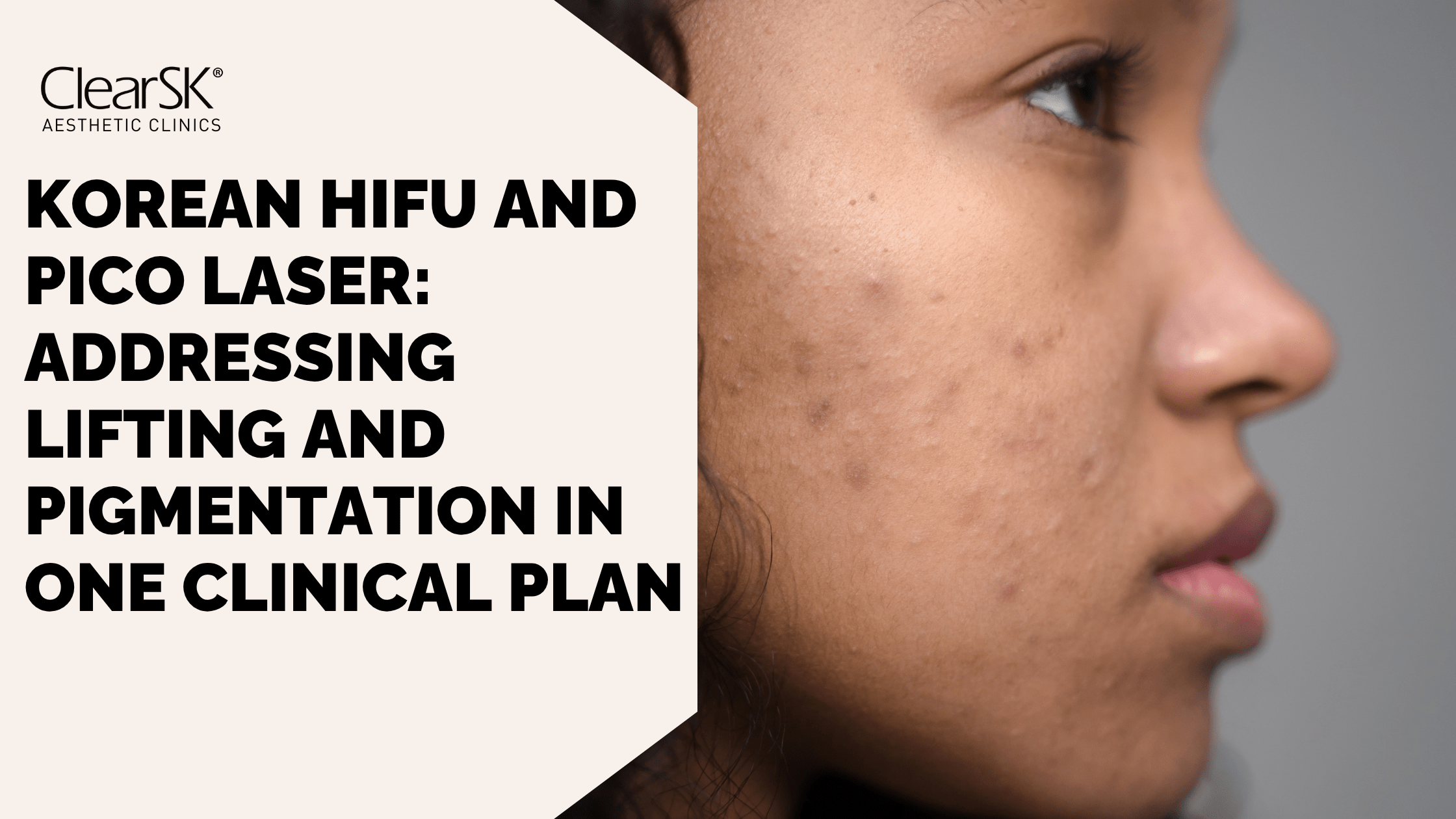Korean HIFU and Pico Laser