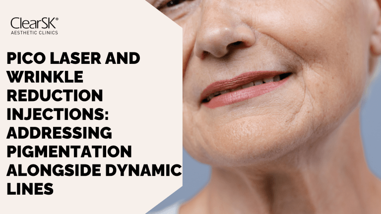 Pico Laser and Wrinkle Reduction Injections Addressing Pigmentation Alongside Dynamic Lines