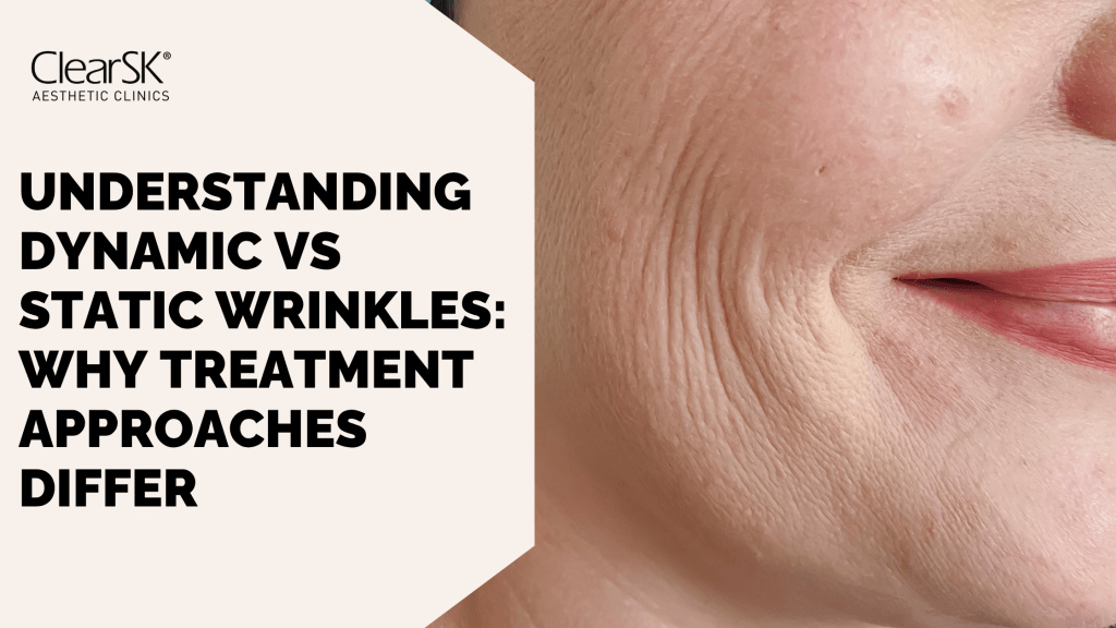 Understanding Dynamic vs Static Wrinkles Why Treatment Approaches Differ