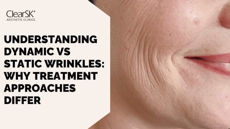 Understanding Dynamic vs Static Wrinkles Why Treatment Approaches Differ