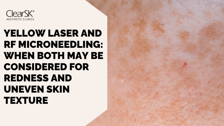 yellow laser and rf microneedling for redness and uneven skin texture